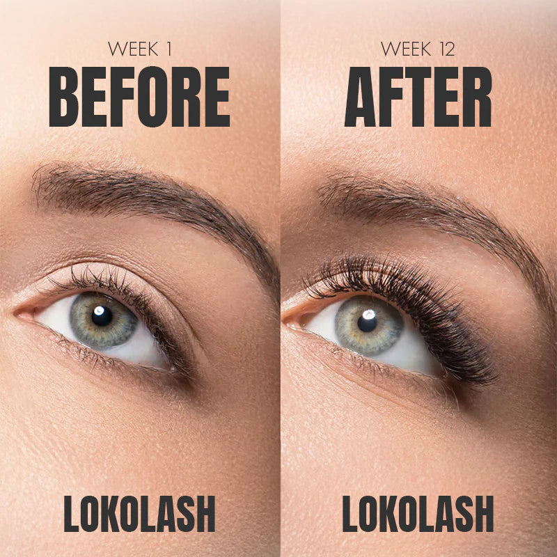 Lokolash